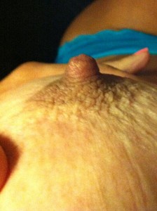 nipple2